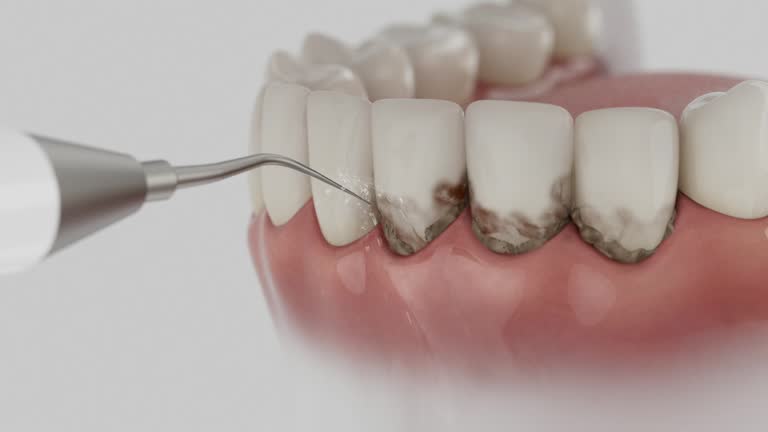 Trusted Tooth Extraction service in San Francisco, CA - Dentist Open Now